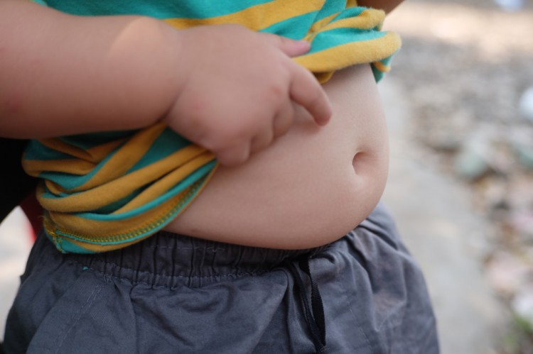 研究證實美國幼兒嚴重肥胖癥正在增加